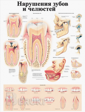 Травмы и болезни организма. Медицинский плакат 3