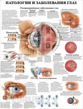 Травмы и болезни организма. Медицинский плакат 5