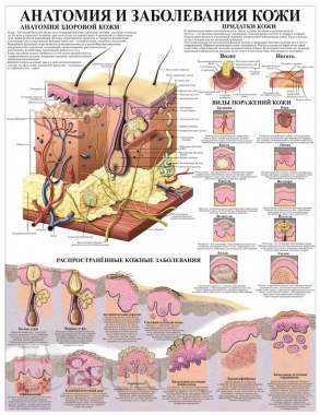 Травмы и болезни организма. Медицинский плакат 7