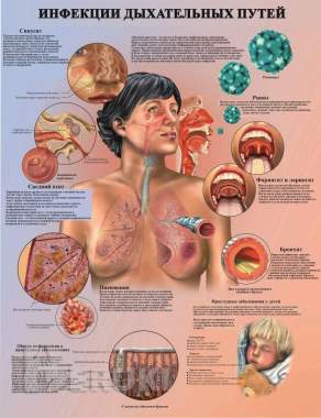 Травмы и болезни организма. Медицинский плакат 8